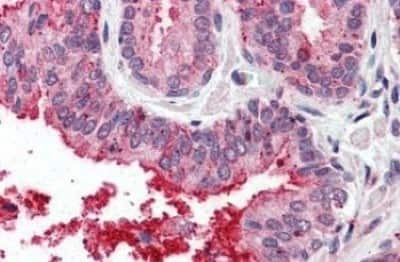 Immunohistochemistry-Paraffin: TSPAN6 Antibody [NBP3-14508]